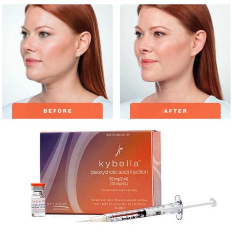 Belkyra (Kybella) .